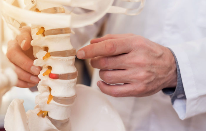 Why Don't Doctors Like Chiropractors?