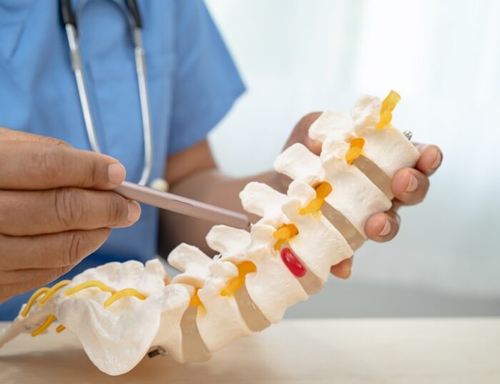 What Is The Best Painkiller For Disc Pain