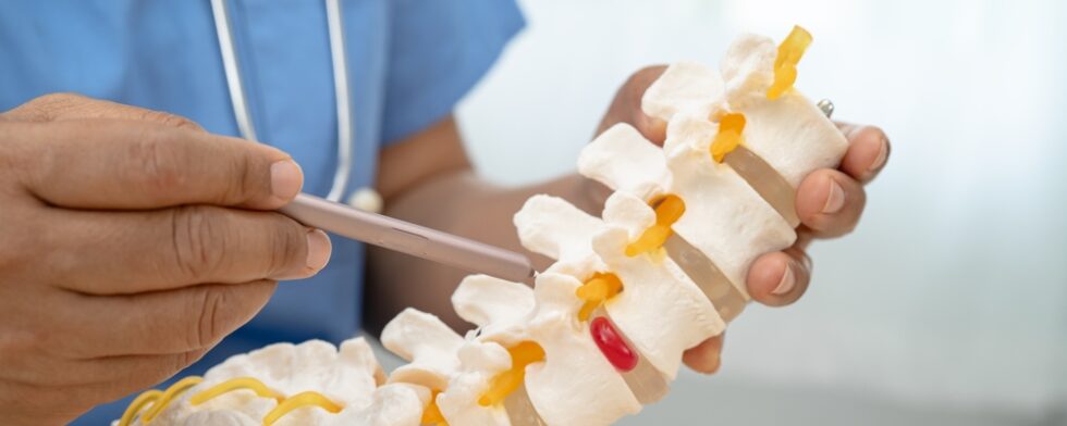 What Is The Best Painkiller For Disc Pain